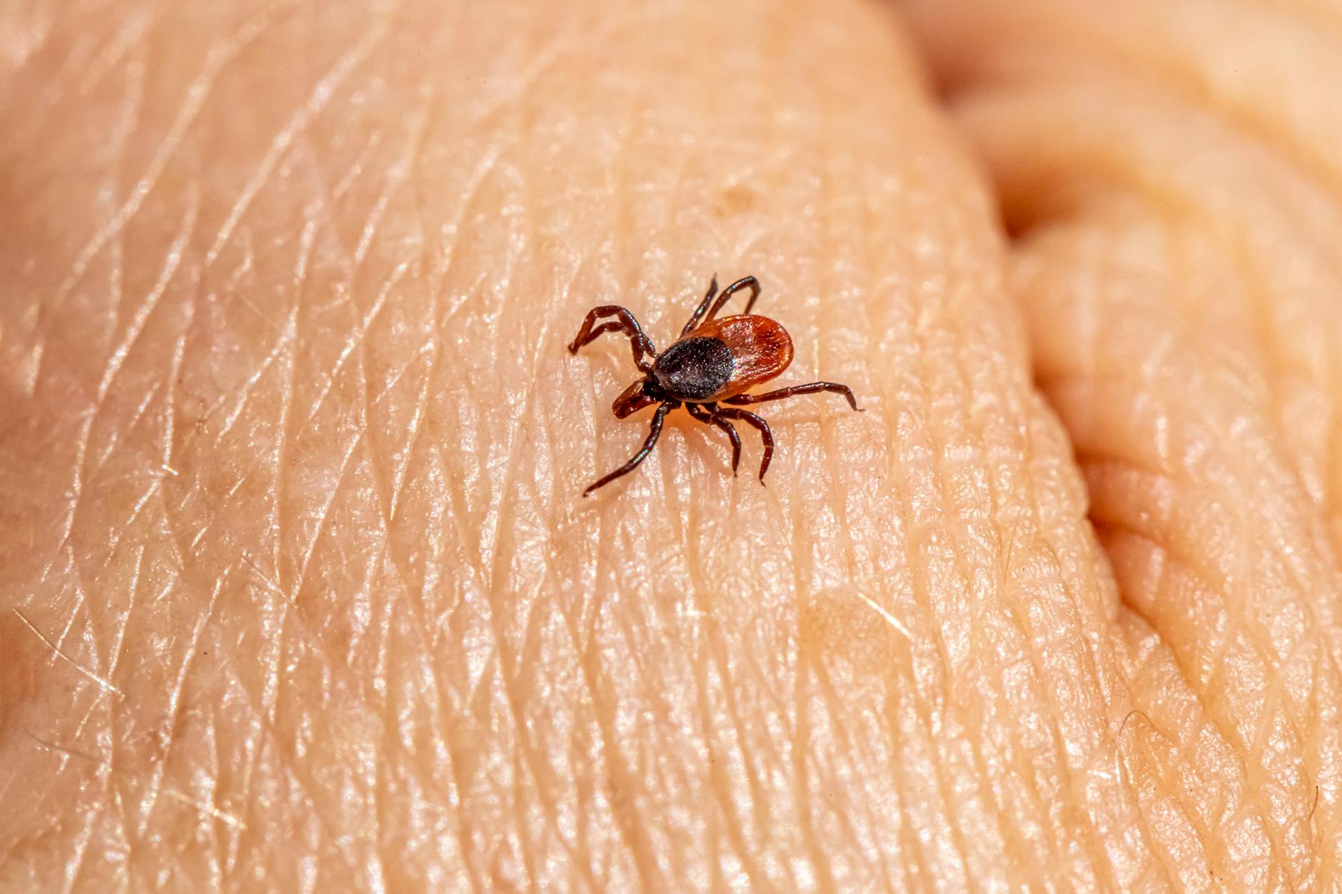 a tick on a person s skin